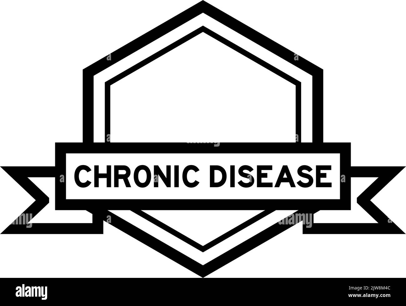 Bannière d'étiquette hexagonale de couleur noire vintage avec mot maladie chronique sur fond blanc Illustration de Vecteur