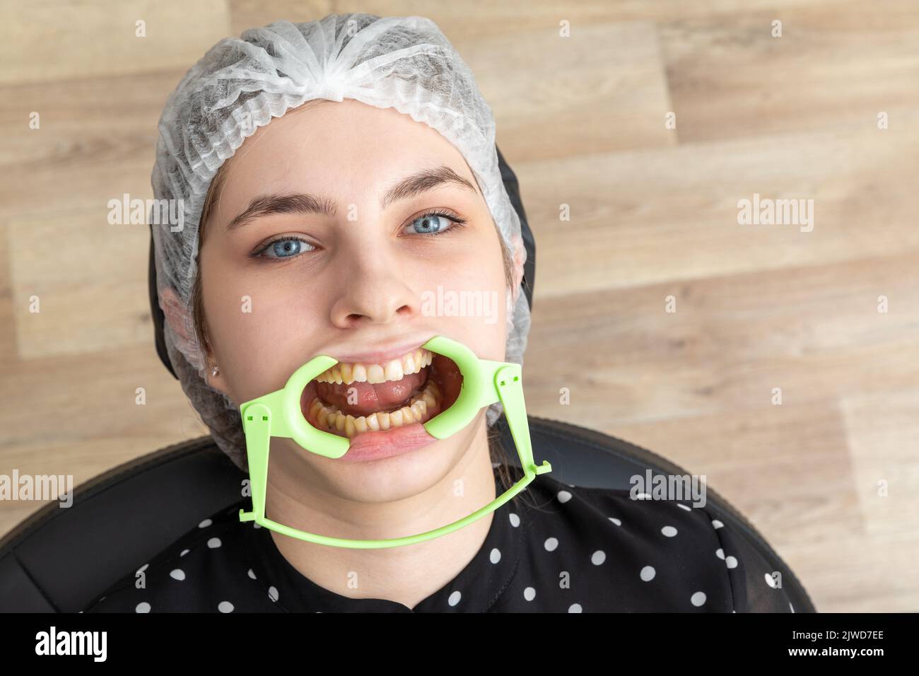 Patient avec enrouleur de joue allongé dans le cabinet du dentiste Banque D'Images Patient avec enrouleur de joue allongé dans le cabinet du dentiste Banque D'Images