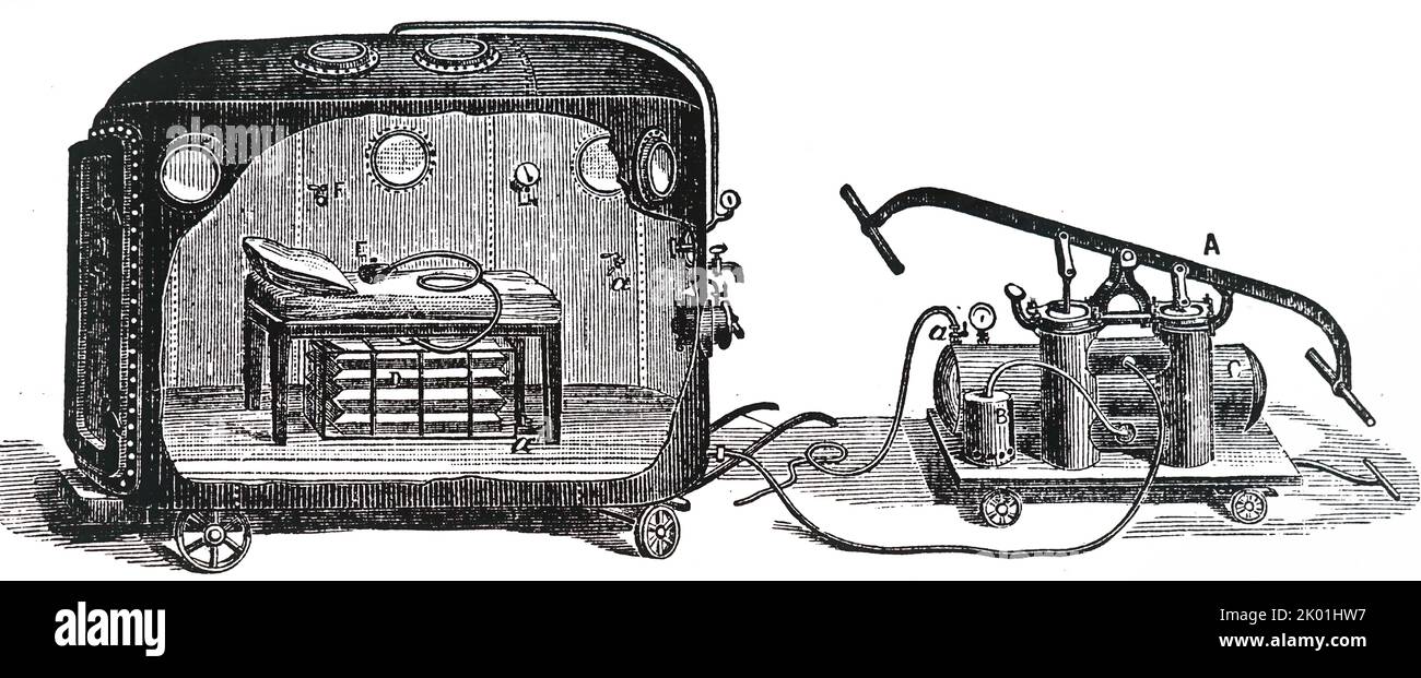 Chambre de la fontaine pour établir l'anesthésie par l'oxyde nitreux (gaz riant) sous pression atmosphérique positive a: Pompe à air; b: réfrigérateur par lequel l'air a été passé; c: Chambre de fonctionnement de la tôle de fer; d: Sac de gaz connecté à la pièce faciale. De Henry M Lyman anesthésie artificielle et Anaesthestics, Londres, 1883. Banque D'Images