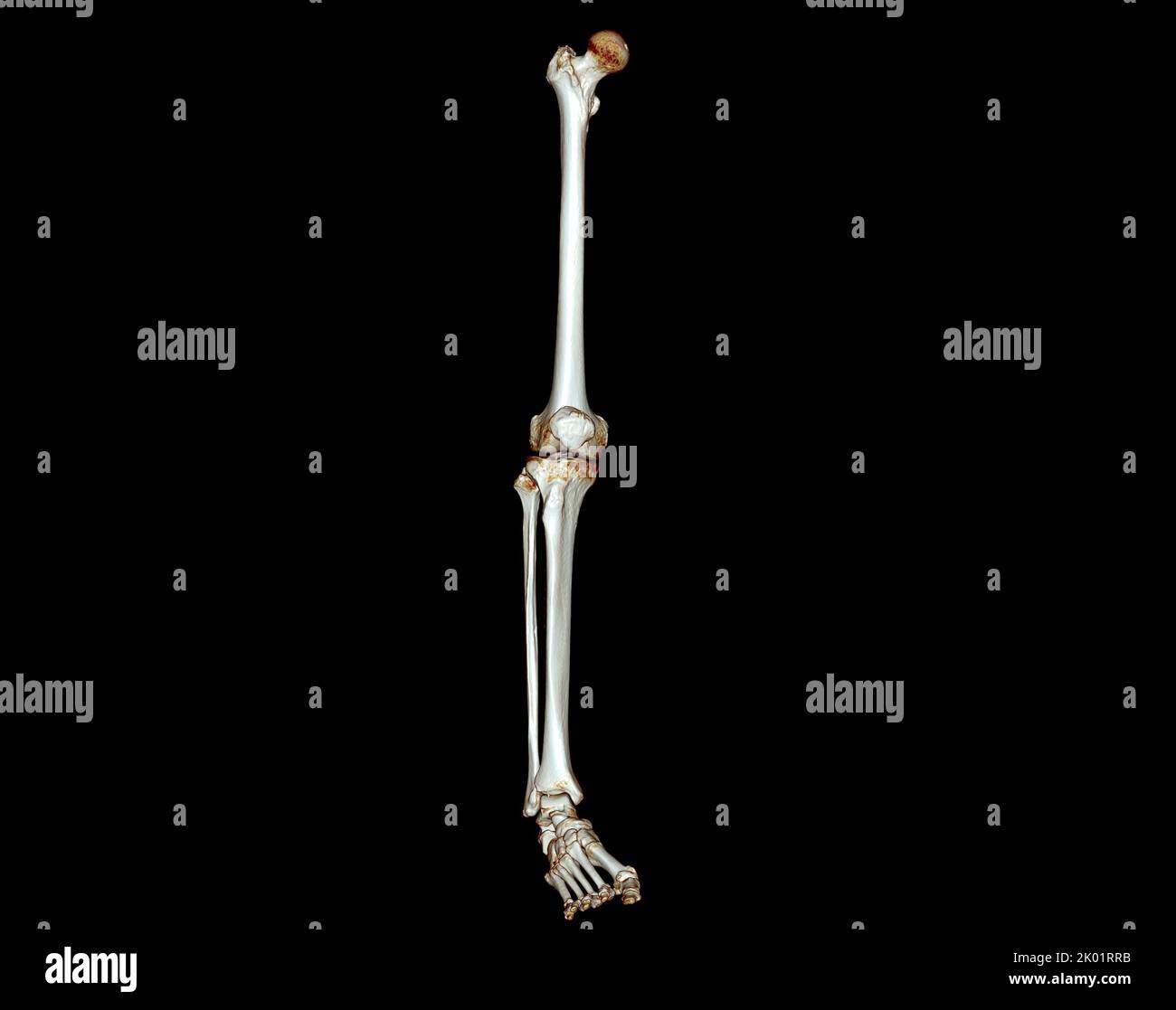 Acquisition CT de l'extrémité inférieure 3D pour le diagnostic de fracture de l'os du fémur , de l'articulation du genou , de la jambe et du pied 3D rendu Banque D'Images Acquisition CT de l'extrémité inférieure 3D pour le diagnostic de fracture de l'os du fémur , de l'articulation du genou , de la jambe et du pied 3D rendu Banque D'Images