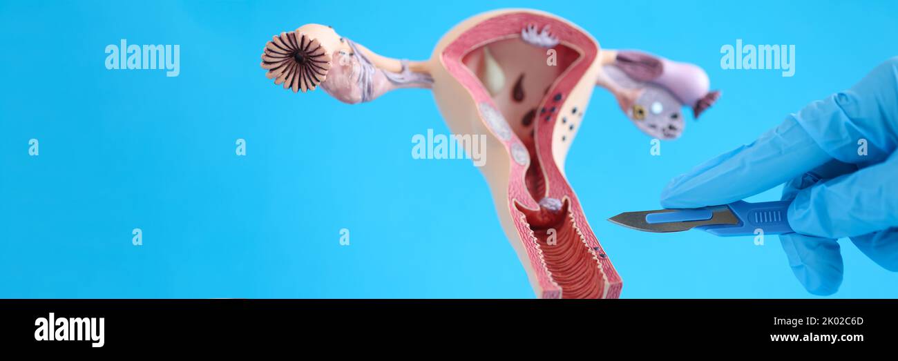 Organe reproducteur féminin Banque de photographies et d’images à haute