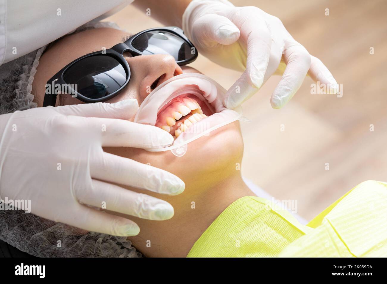 Dentiste installant un rétracteur de joue de patient dans un cabinet de dentiste Banque D'Images Dentiste installant un rétracteur de joue de patient dans un cabinet de dentiste Banque D'Images