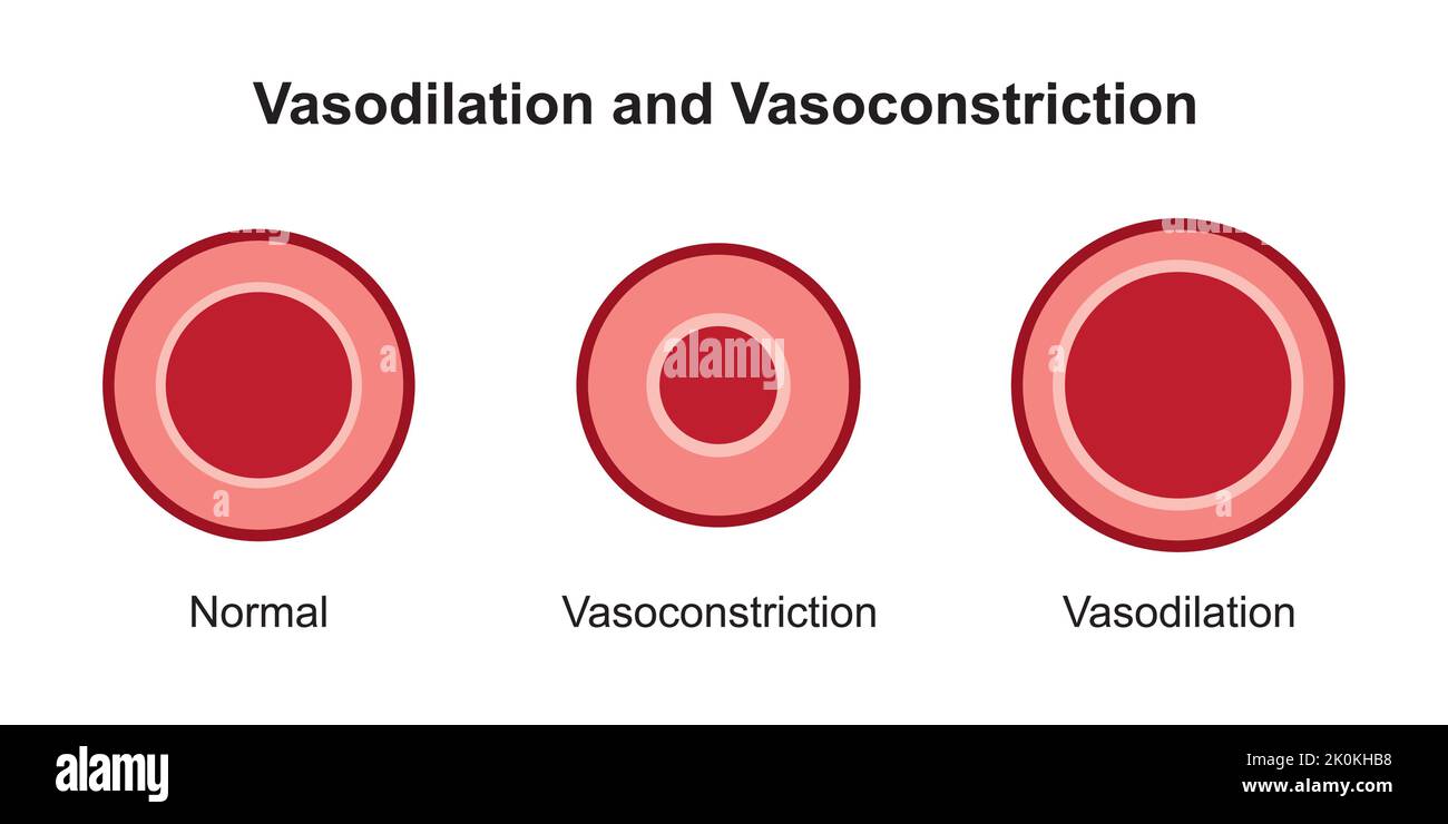 Conception scientifique de la vasoconstriction artérielle et de la vasodilatation. Comparaison entre les vaisseaux sanguins normaux, constriés et dilatés. Vecteur. Illustration de Vecteur