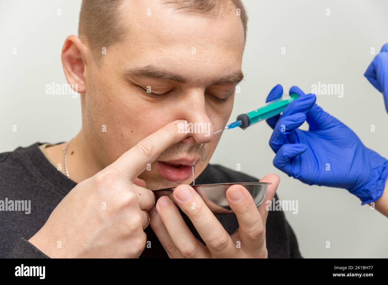 Une infirmière rince la cavité nasale d'un patient souffrant de sinusite avec une solution saline à l'aide d'une seringue. Banque D'Images