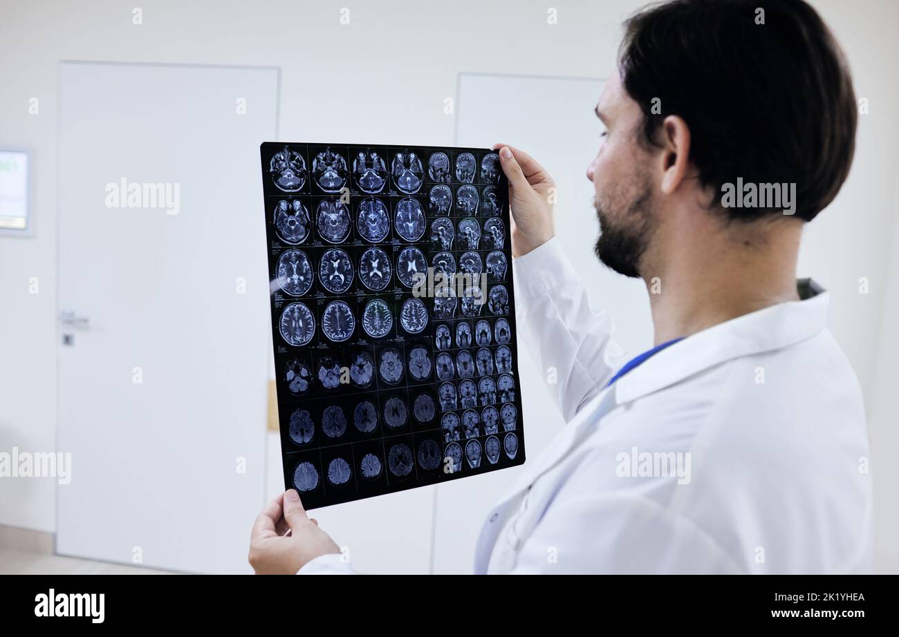 Médecin généraliste regardant l'IRM du cerveau humain et examinant l'anatomie et la pathologie du cerveau du patient en se tenant dans un hôpital de couloir Banque D'Images