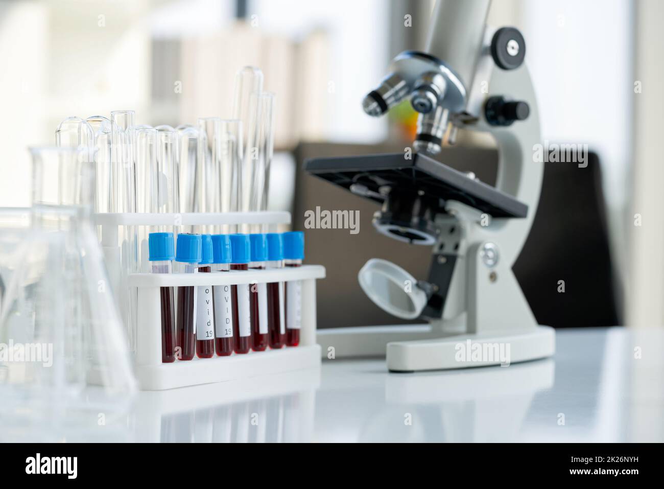 Les tubes de prélèvement sanguin des patients Covid 19 sont placés à côté du microscope sur une table de laboratoire blanche. Maladie à coronavirus 2019 processus de dépistage en laboratoire pour prévenir la propagation de la recherche virale. Banque D'Images