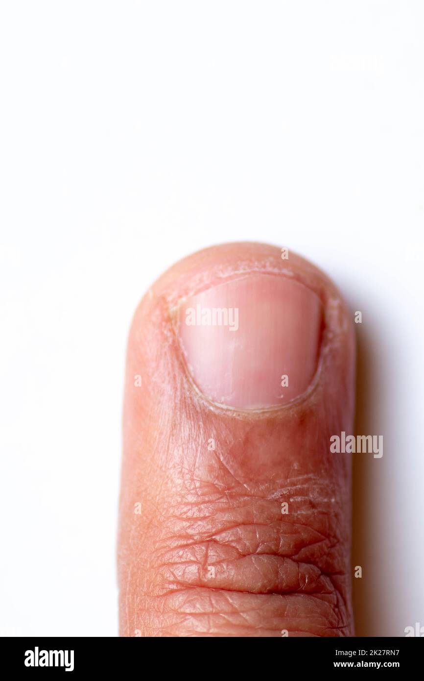 Orteils, mains et ongles. Parties du corps humain masculin âgées de 20 à 30 ans Banque D'Images