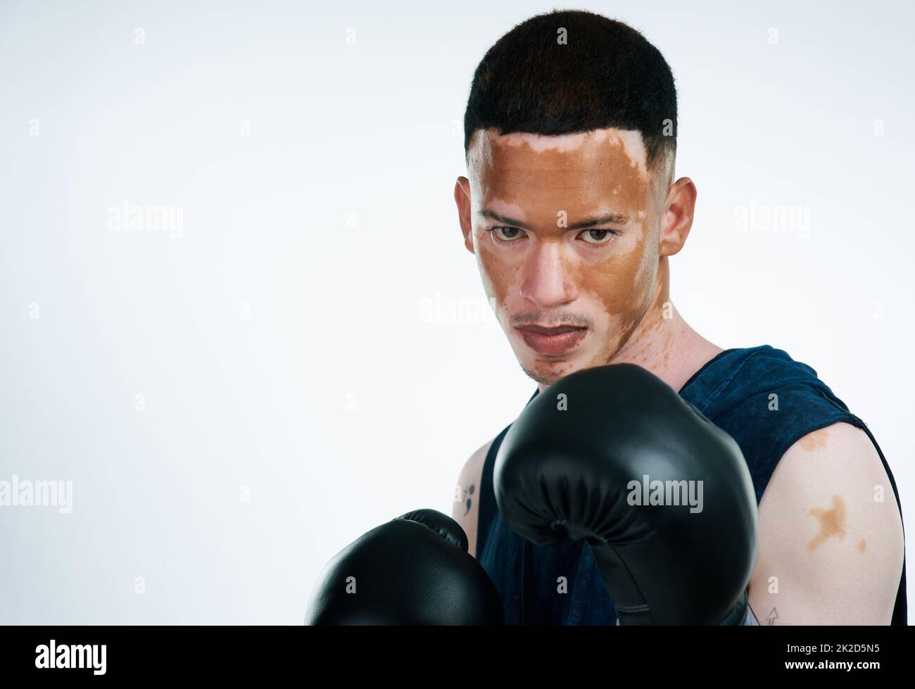 Lorsque la vie devient plus difficile, mettez-vous au défi d'être plus fort. Portrait d'un joli petit boxeur mâle avec vitiligo posé en studio. Banque D'Images