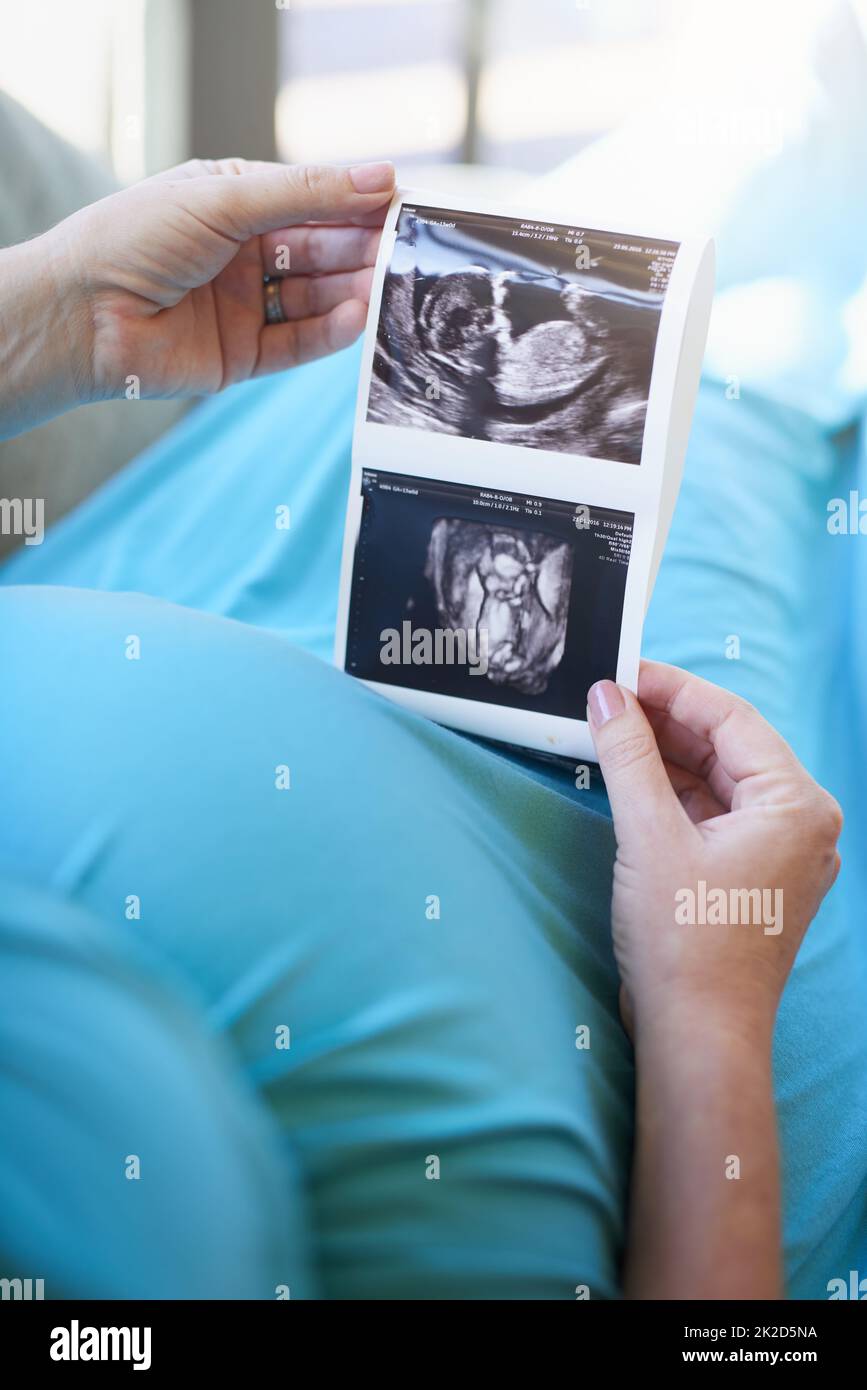 Première photo de Babys. Prise de vue d'une femme enceinte non identifiable tenant une image d'un échogramme tout en se relaxant à la maison. Banque D'Images