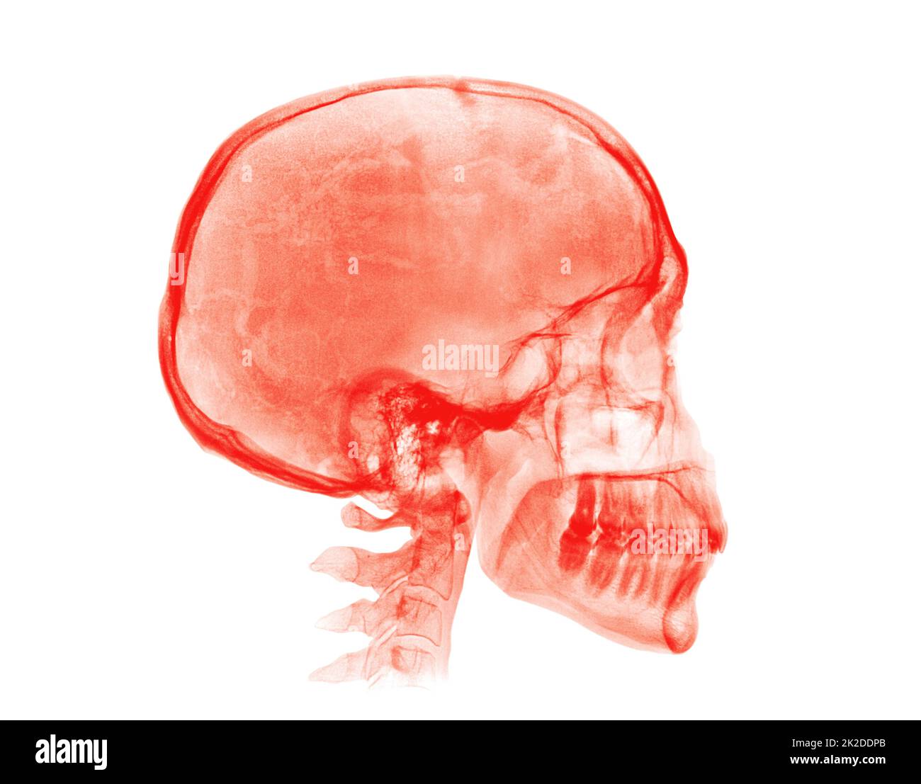 Crâne humain. Image radiologique rouge sur fond blanc Banque D'Images