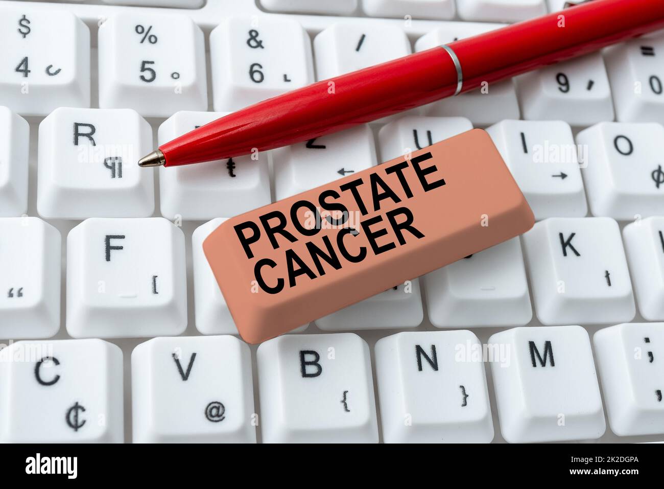 Organe reproducteur masculin Banque - Legende Conceptuelle Cancer De La Prostate Idee D Affaires Cancer Qui Se Produit Dans La Glande Du Systeme Reproducteur Masculin Resume Fixation De Sites Web Obsoletes Le Maintien De La Connexion Internet 2k2dgpa 
