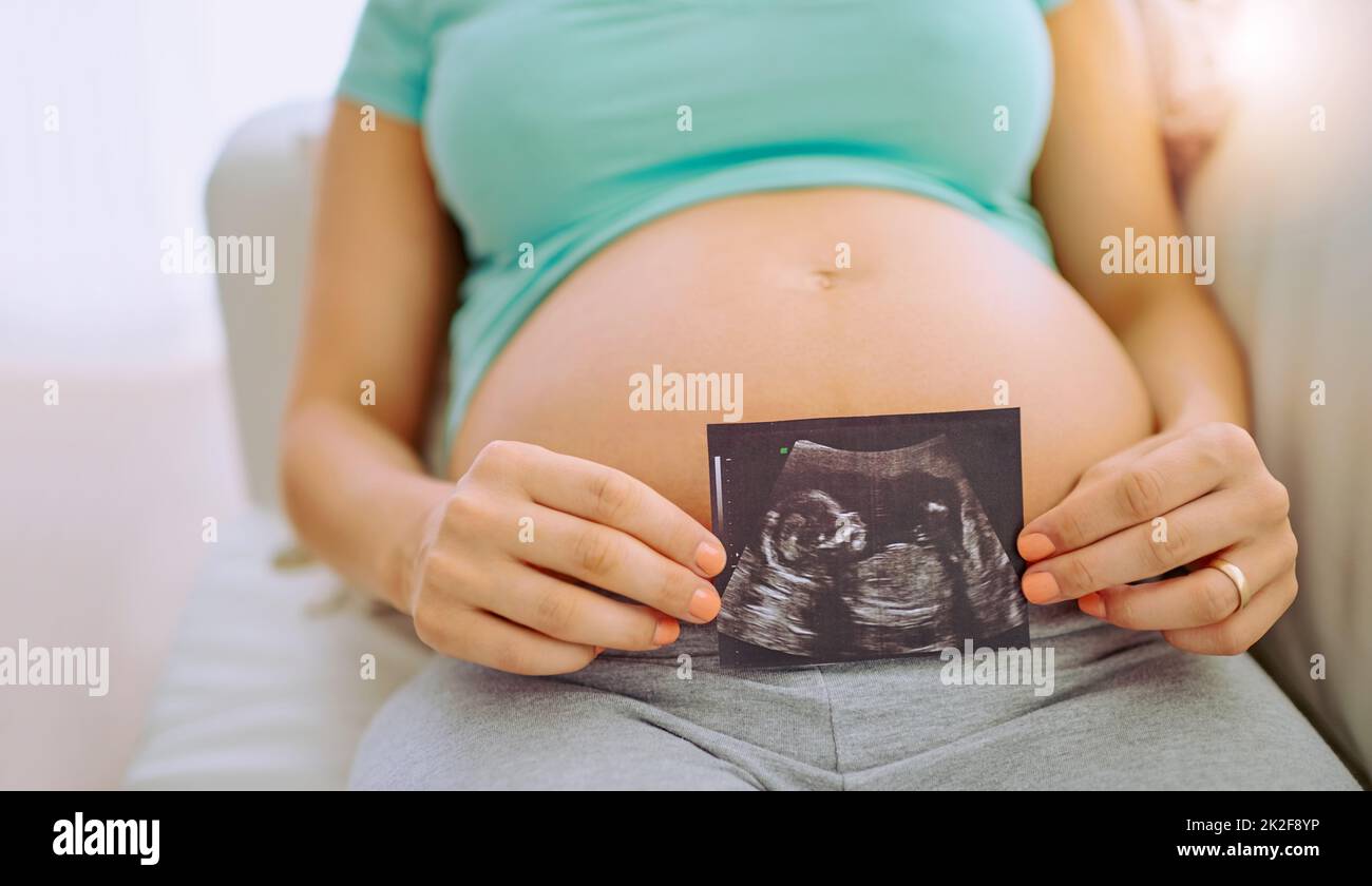 Rencontrez le petit humain à l'intérieur de mon ventre. Gros plan d'une femme enceinte tenant une image d'un échogramme contre son ventre à la maison. Banque D'Images