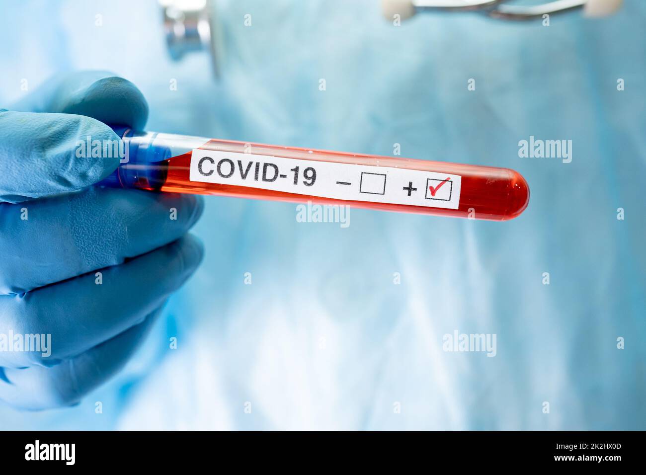 Échantillon positif d'infection sanguine dans une éprouvette pour covid19 coronavirus en laboratoire. Scientifique chargé de vérifier et d'analyser la présence d'un patient à l'hôpital. Banque D'Images