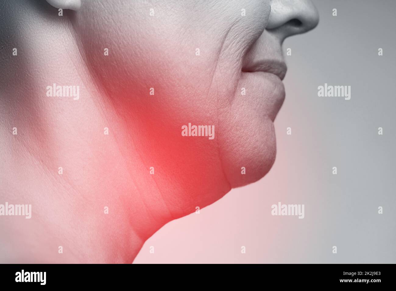 Concepts de problèmes avec la thyroïde ou mal de gorge. Banque D'Images