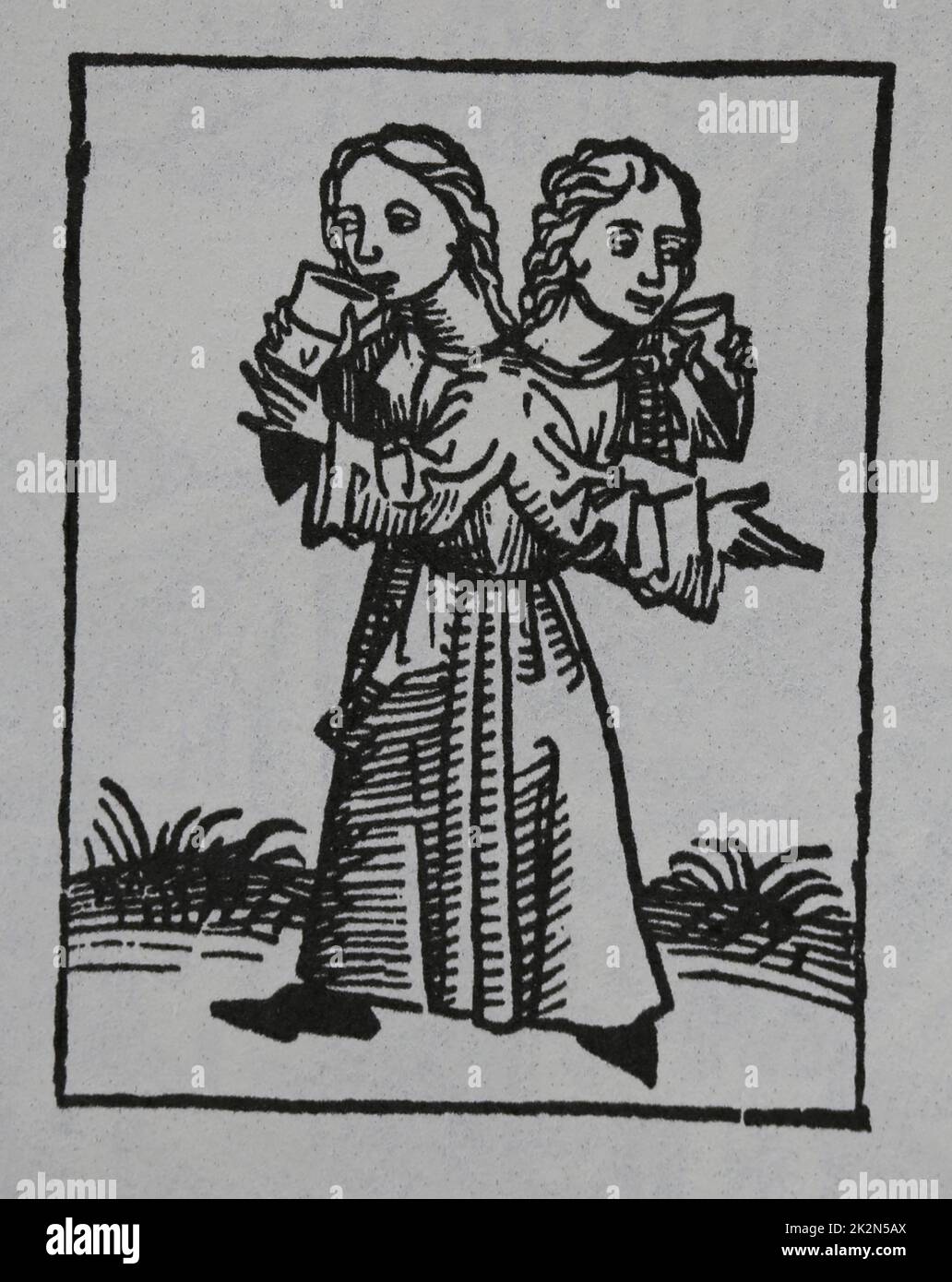 Jumeaux joints ou siameses jumeaux. Gravure. Le Cronicle de Nuremberg, 15th siècle. Banque D'Images