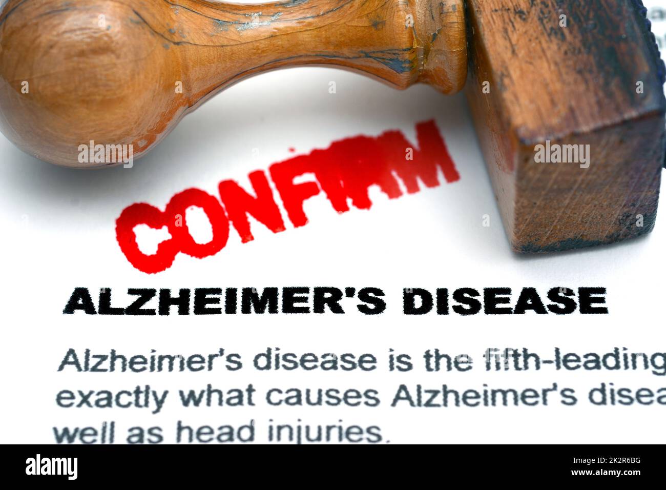La maladie d'Alzheimer Banque D'Images