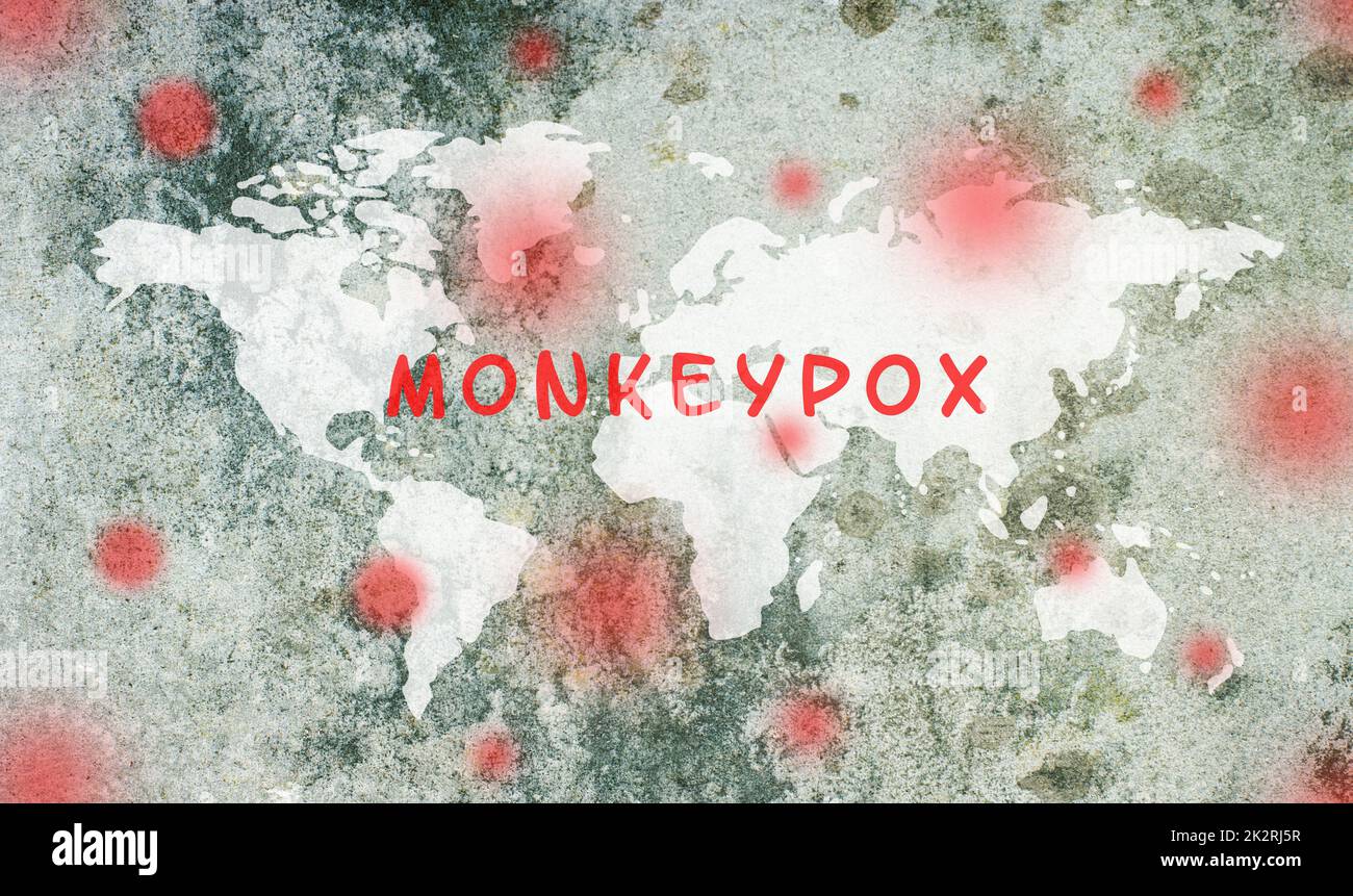 Carte du monde, la monkeypox est debout sur le fond texturé, l'épidémie du virus MPXV, la propagation de maladies infectieuses, la pandémie Banque D'Images