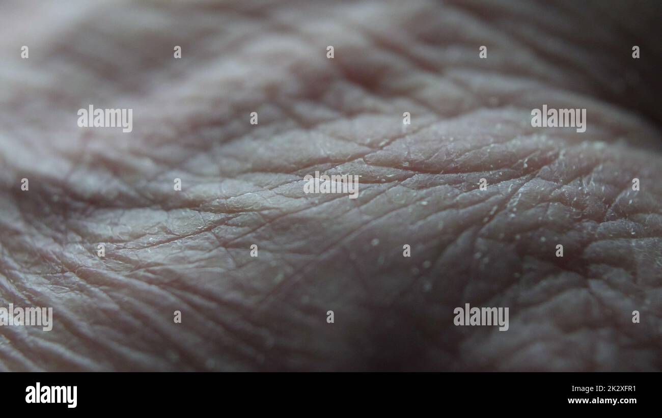 Gros plan des mains des aînés atteints de la maladie d'Alzheimer Banque D'Images