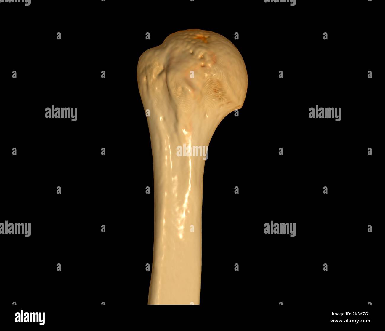 Acquisition CT de la tête de l'humérus 3D de la tomodensitométrie rendu volumique examen de l'humérus os 3D rendu en cas de fracture de l'articulation de l'épaule. Banque D'Images