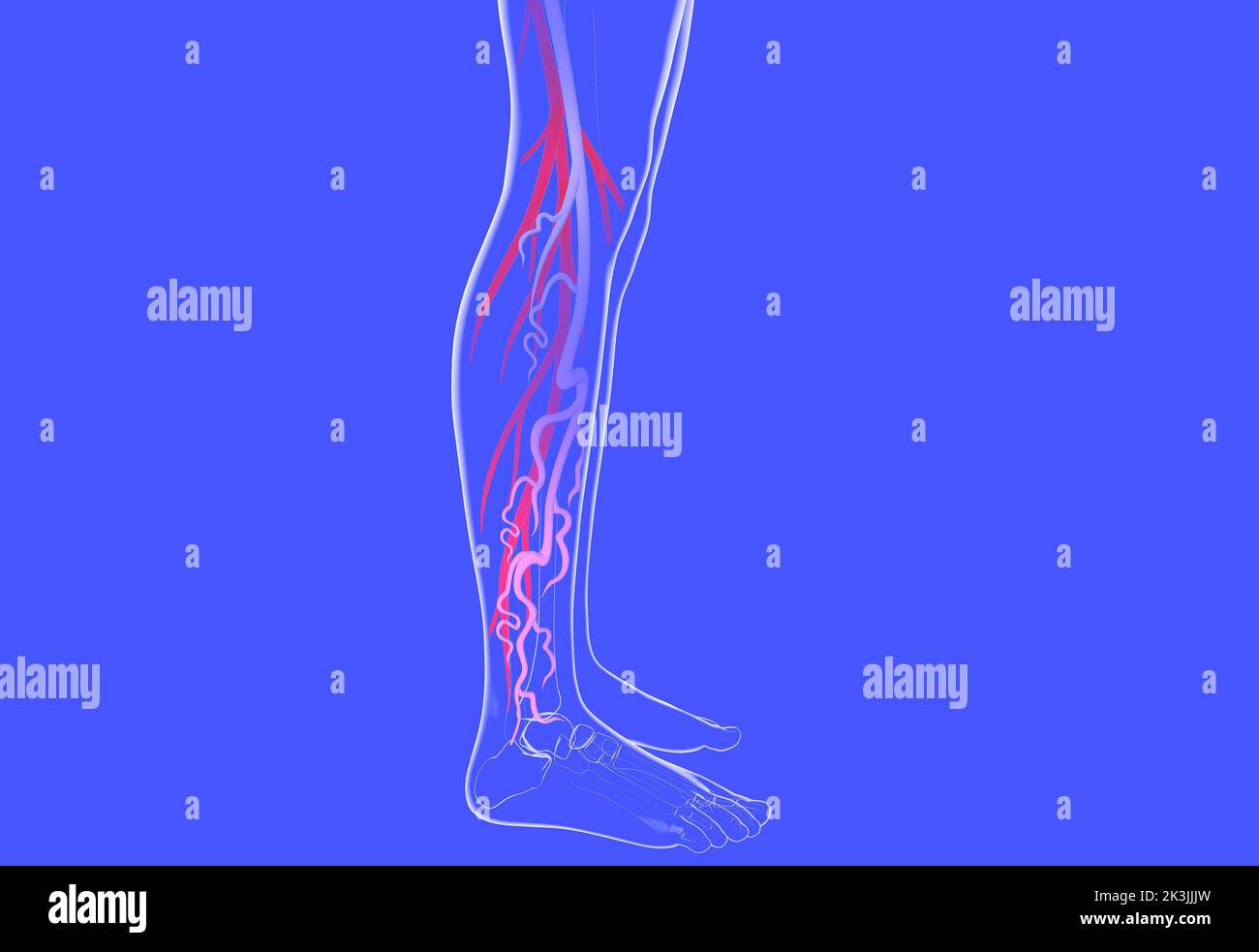 3d illustration du système veineux avec varices. Anatomie transparente de la jambe humaine. Banque D'Images