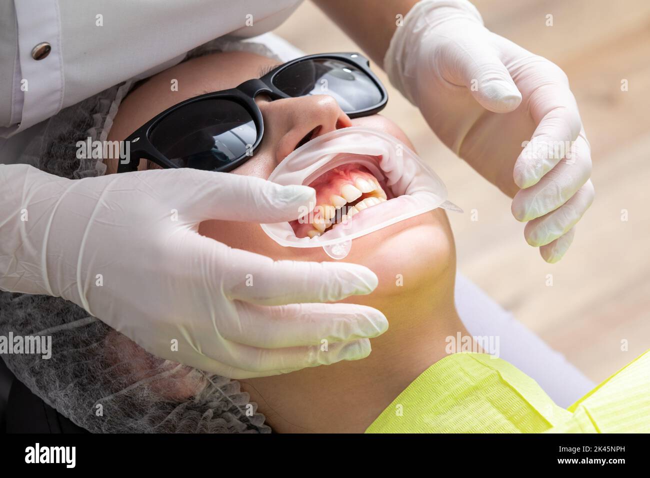 Patient avec enrouleur de joue allongé dans le cabinet du dentiste Banque D'Images Patient avec enrouleur de joue allongé dans le cabinet du dentiste Banque D'Images