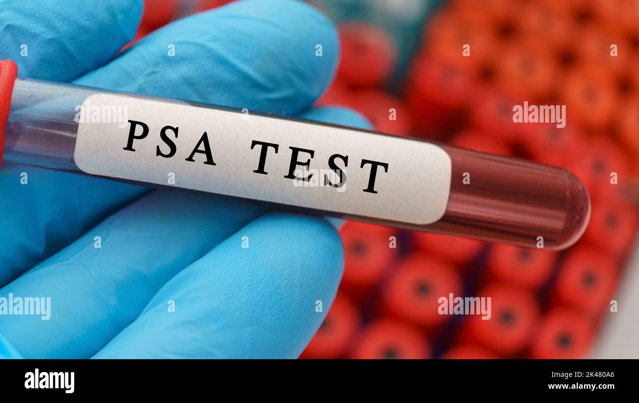 Test d'antigène spécifique de la prostate, image conceptuelle Banque D'Images