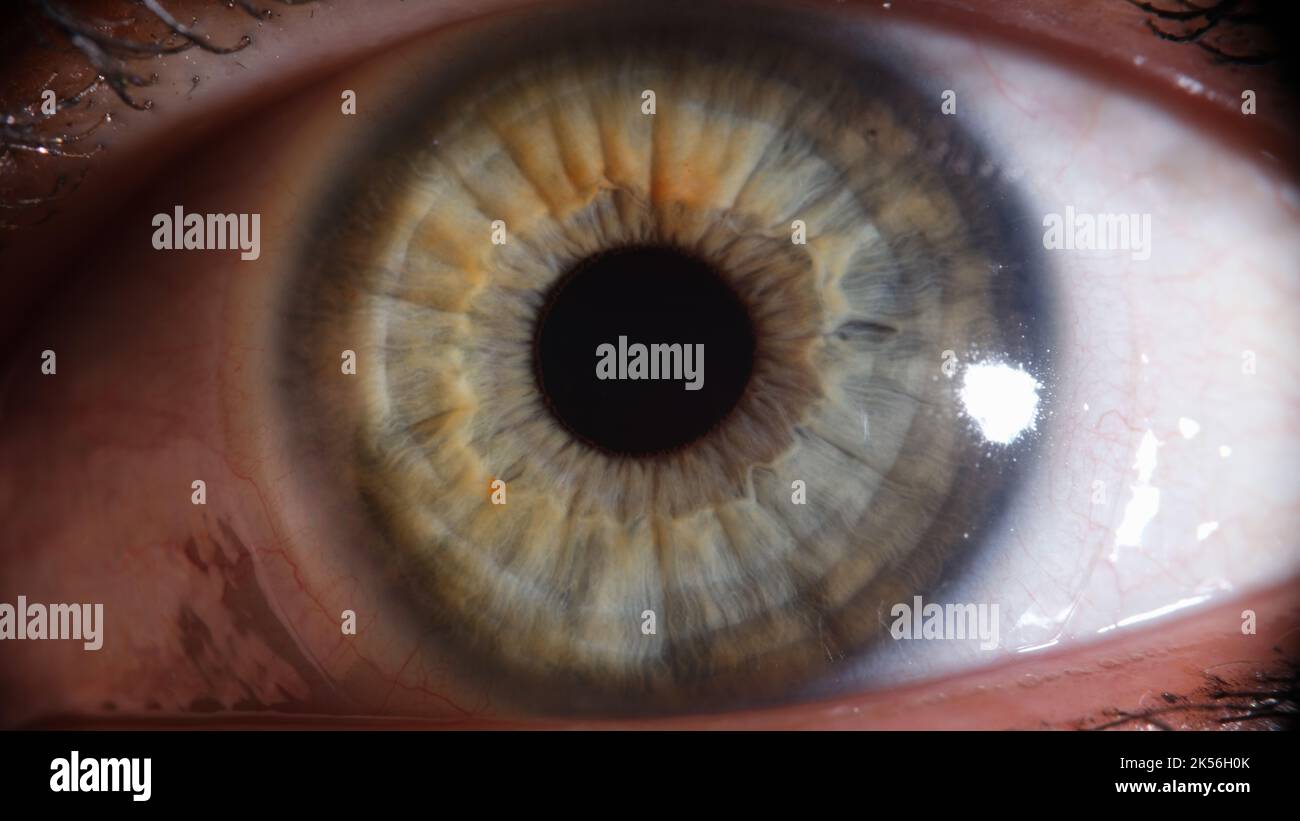 Gros plan des yeux rouges endommagés ou irrités Banque D'Images