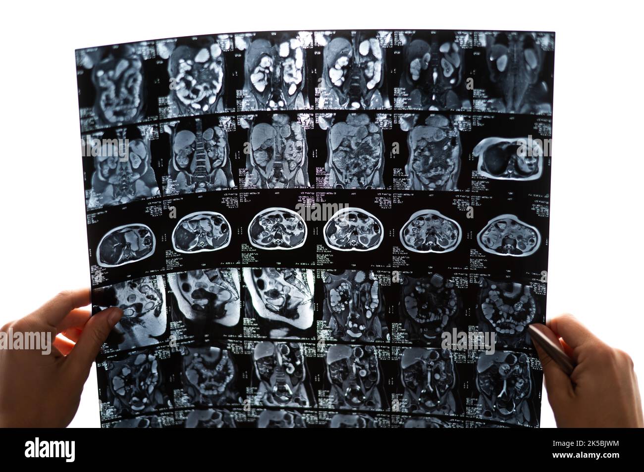 Une femme médecin examine une IRM des organes internes. Abdomen. Banque D'Images