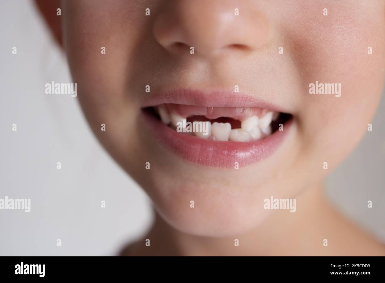 Bouche d'un enfant sans dents de lait gros plan. Banque D'Images