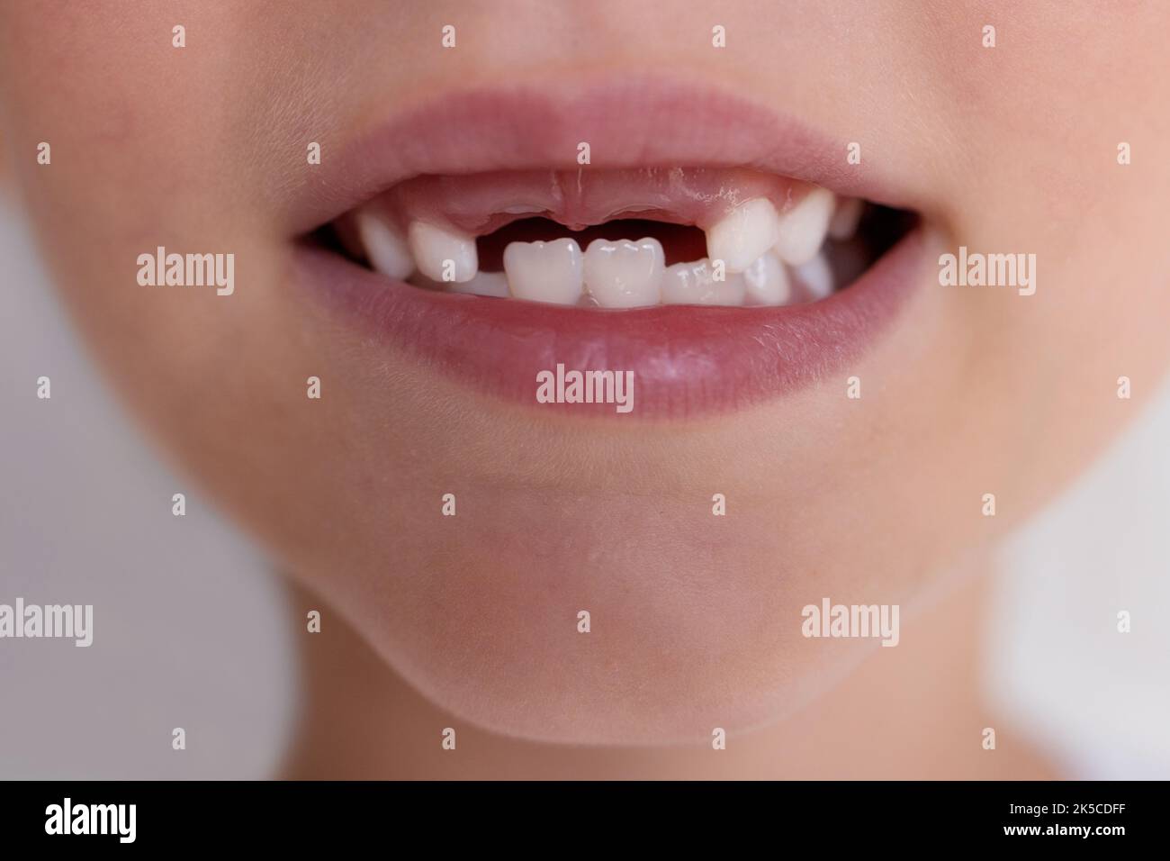 Gros plan de la bouche d'un enfant sans dents avant de lait. Banque D'Images
