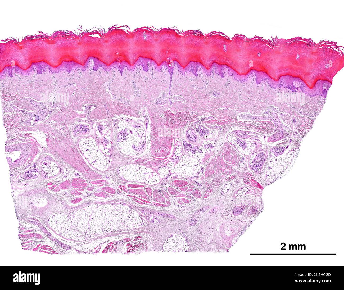 Micrographe à faible puissance de microscope à lumière de la peau humaine glabre. De haut, l'épiderme, un épithélium squameux stratifié kératinisé montrant une proéminence Banque D'Images