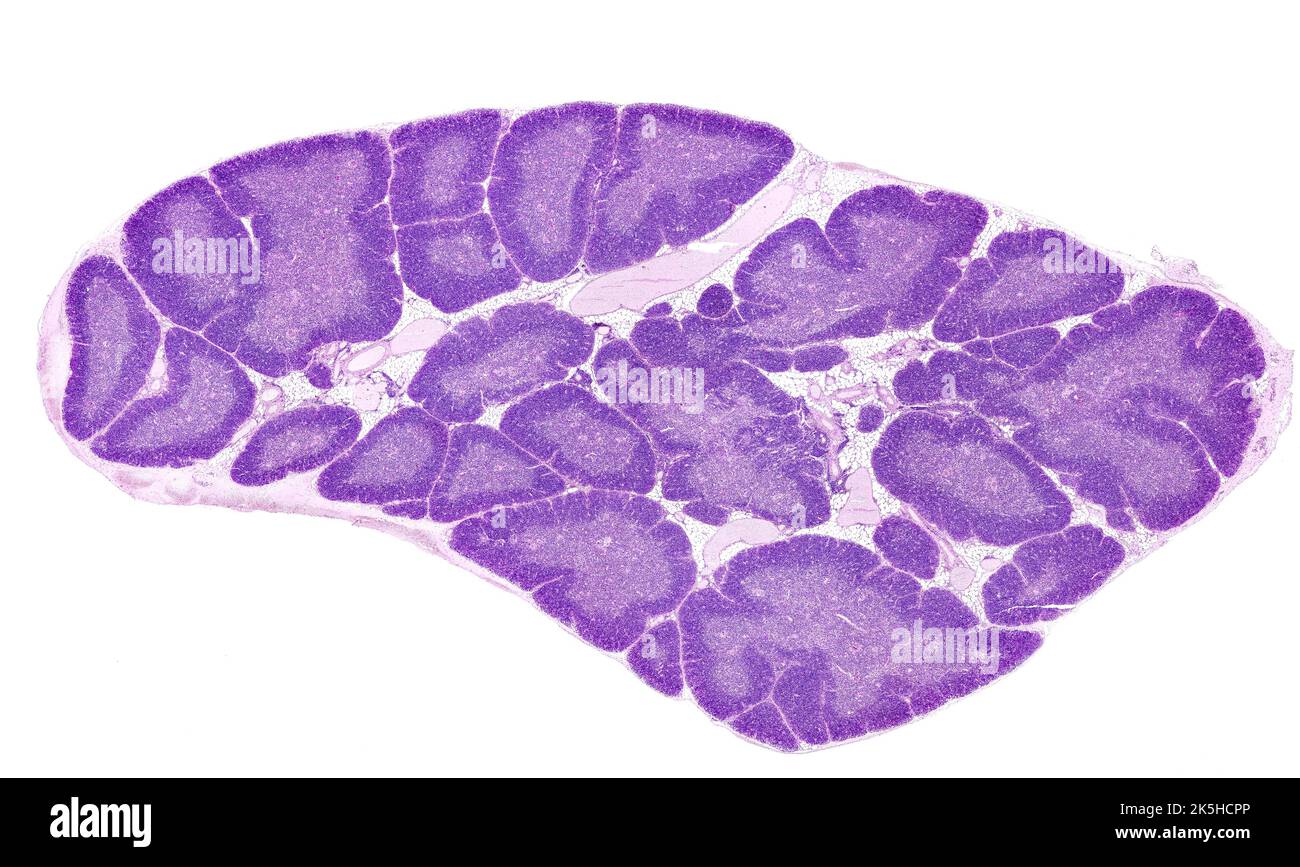 Microscope à lumière de faible puissance micrographe d'une glande de thymus humaine colorée avec LUI. Le parenchyme thymique est composé de lobules séparés par un tissu adipeux Banque D'Images
