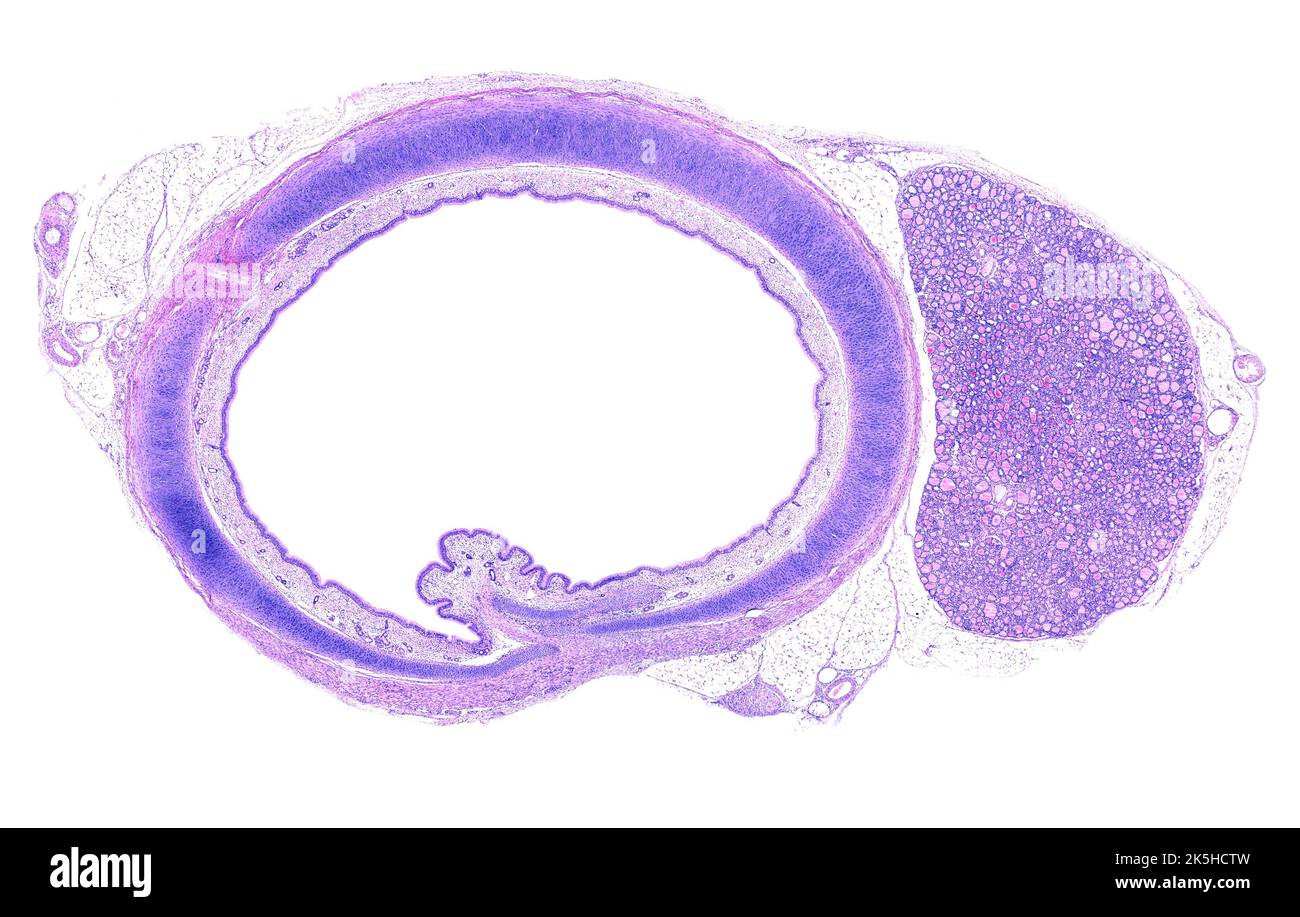 Micrographe à microscope léger de faible puissance d'une section transversale de la trachée, montrant des anneaux trachéaux en forme de C de cartilage hyaliné. La muqueuse trachéale est Banque D'Images