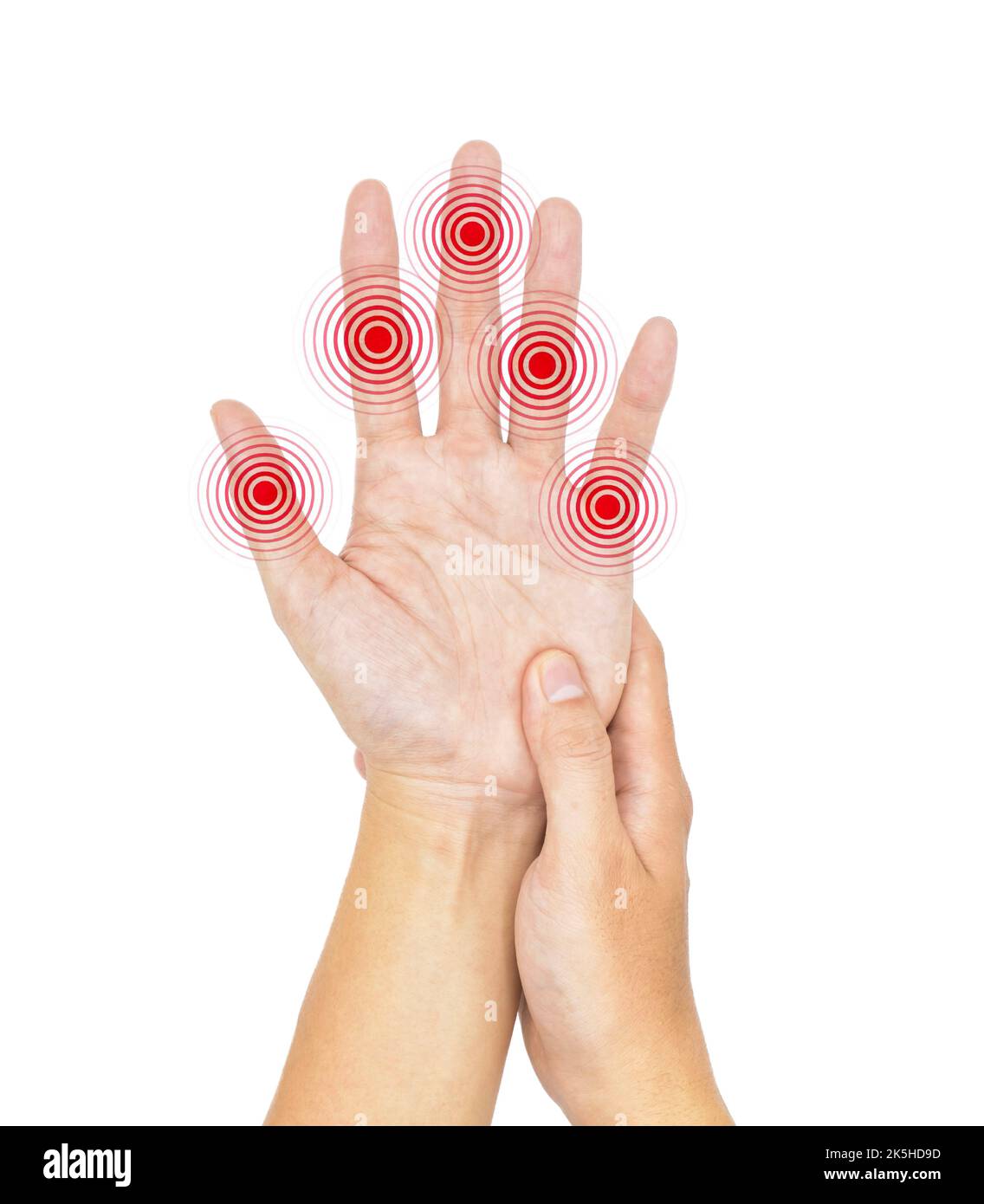 Inflammation de plusieurs articulations. Concept et idée d'arthrite rhumatismale, de polyarthrite, de gonflement des articulations des mains ou d'arthralgie. Banque D'Images