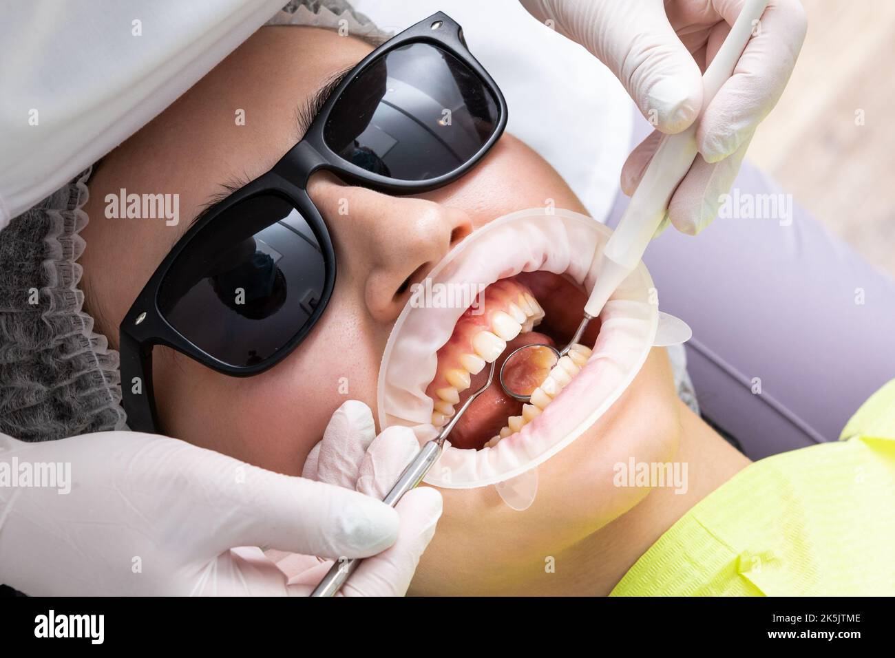 Patient avec enrouleur de joue allongé dans le cabinet du dentiste Banque D'Images Patient avec enrouleur de joue allongé dans le cabinet du dentiste Banque D'Images