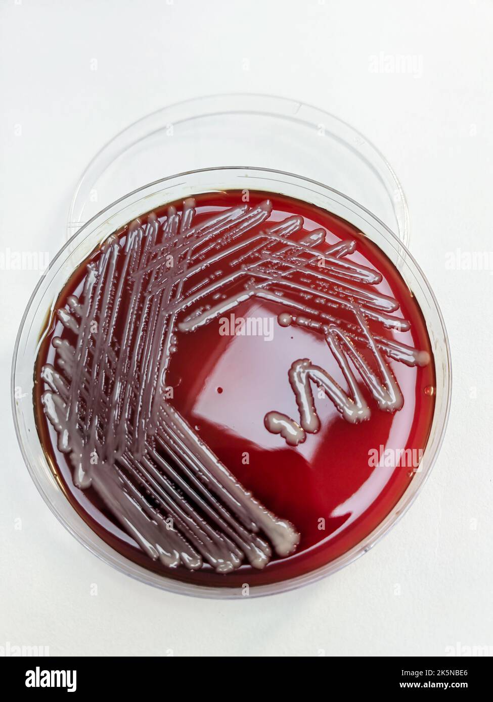 Une bactérie SARM staphylococcus aureus affichée sur une plaque de gélose au sang sur une surface blanche Banque D'Images