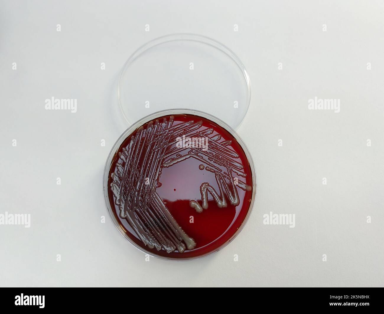 Une bactérie SARM staphylococcus aureus affichée sur une plaque de gélose au sang sur une surface blanche Banque D'Images