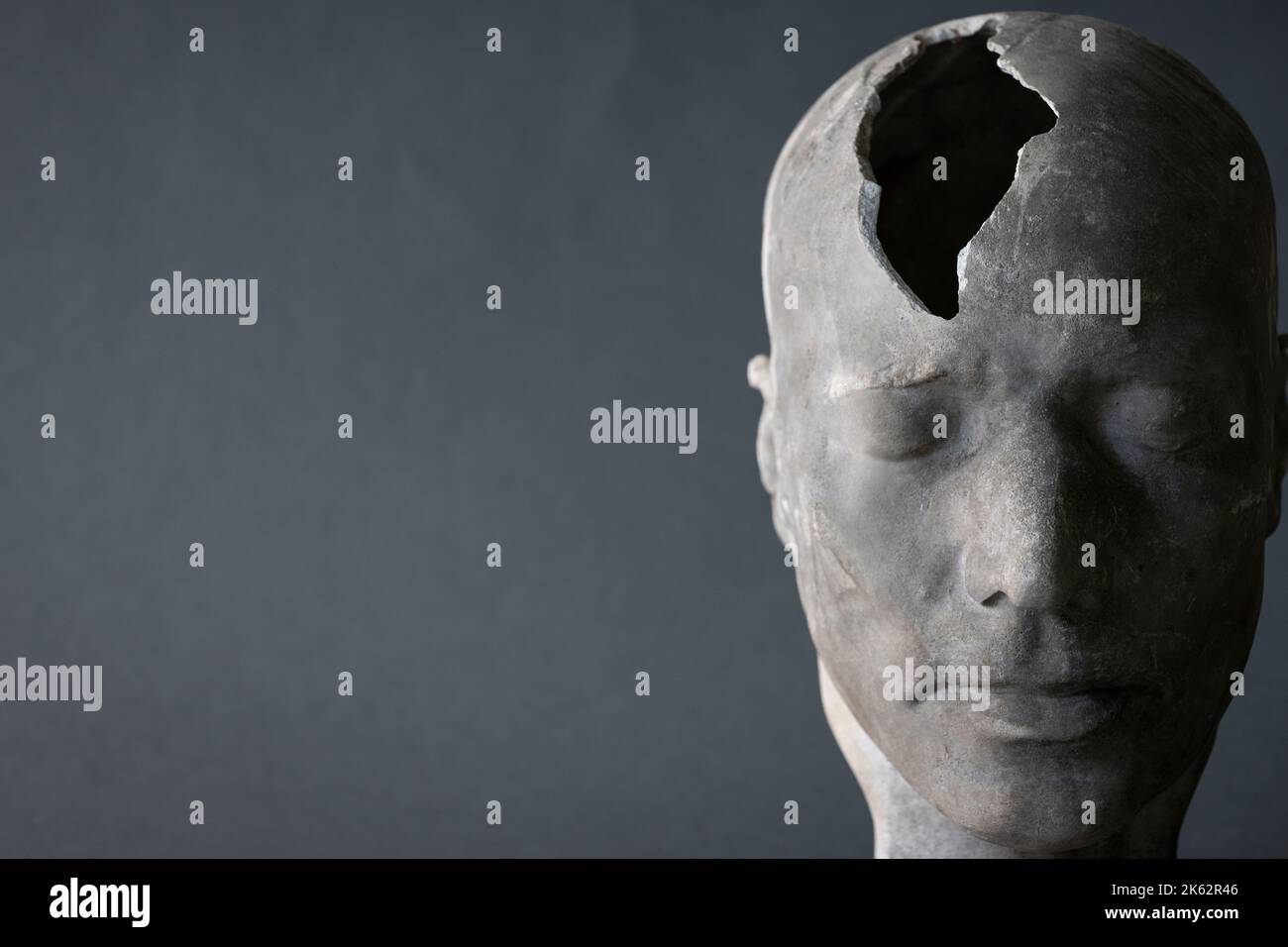 Concept de santé mentale montrant le modèle de tête avec pièce fracturée dans le crâne Banque D'Images