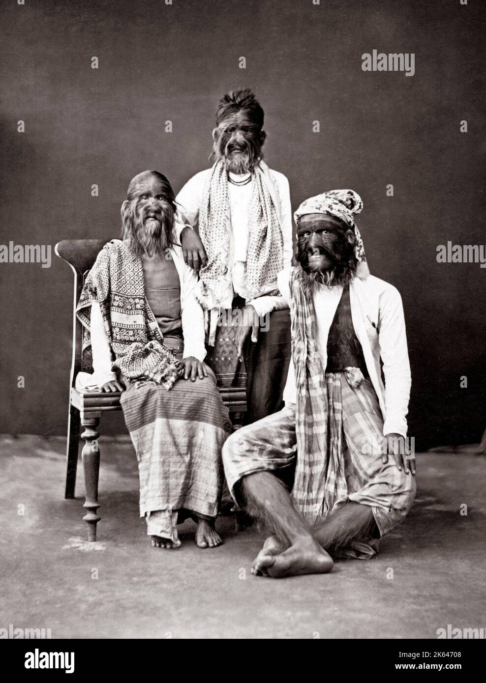 C. Années 1860 L'Inde - la famille poilue de la Birmanie - l'hypertrichose congénitale lanuginosa - ils sont devenus célèbre comme une attraction spectacle freak show et loi. Banque D'Images