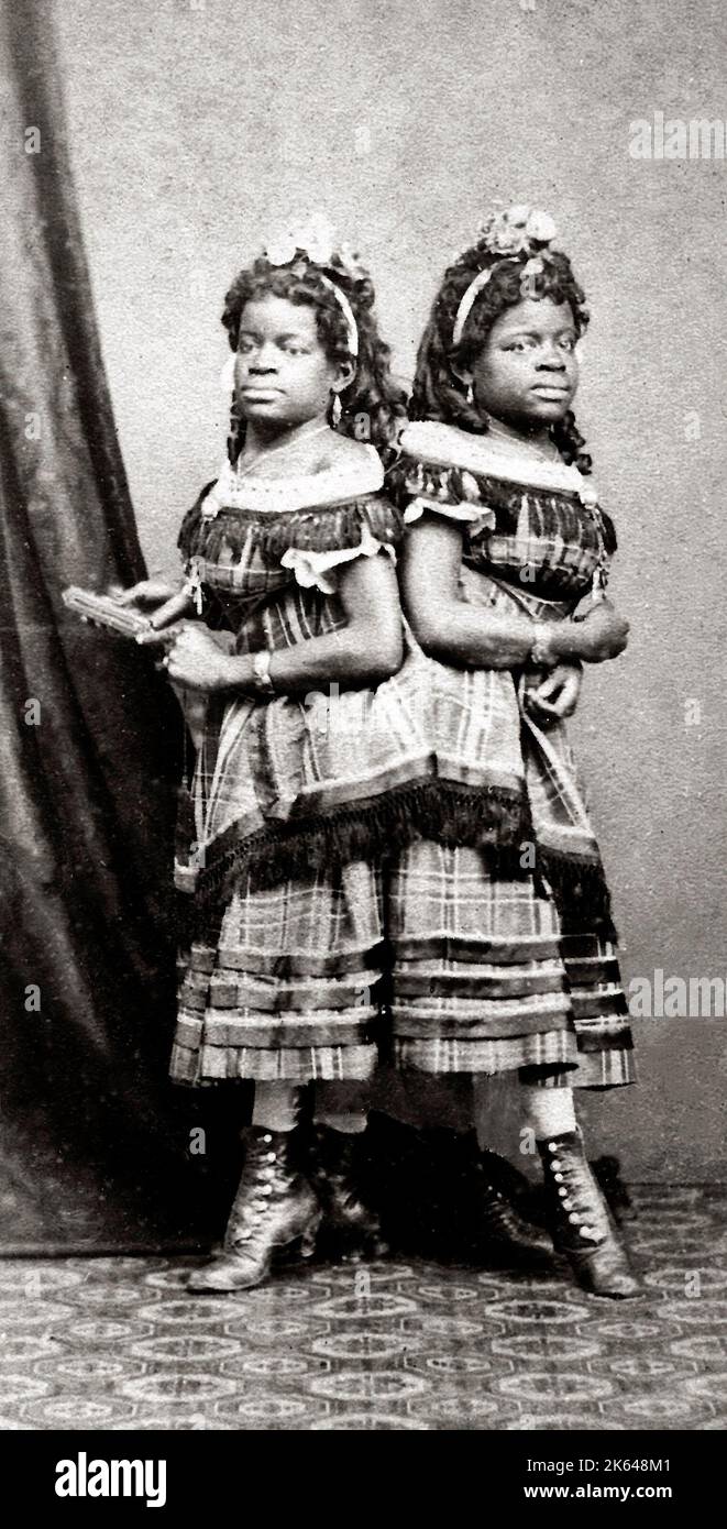 Millie et Christine McKoy étaient des jumelles accolées américaines qui portaient les noms de scène The Carolina Twins, The Two-headed Nightingale et The Eighth Wonder of the World Banque D'Images