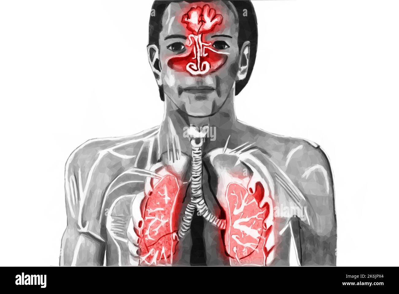 Froid voies respiratoires supérieures exposées. Vecteur en style poly bas. Illustration de Vecteur