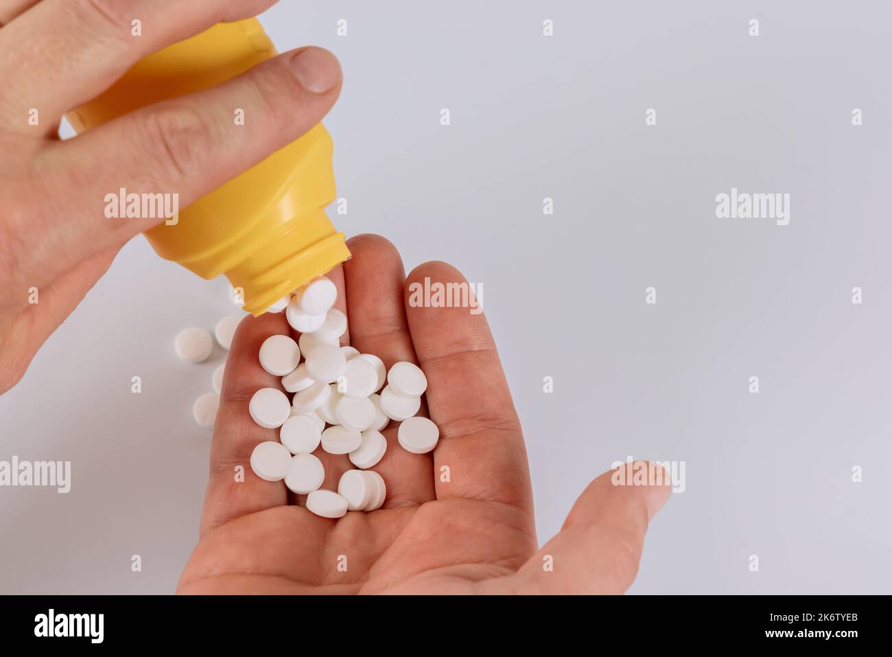 Au cours du traitement médical, il y a des éruptions cutanées sur les mains causées par des pilules médicinales Banque D'Images