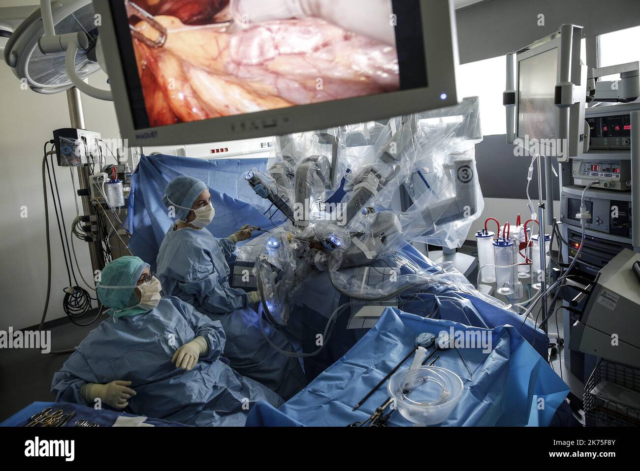 Chirurgie robotique à l
