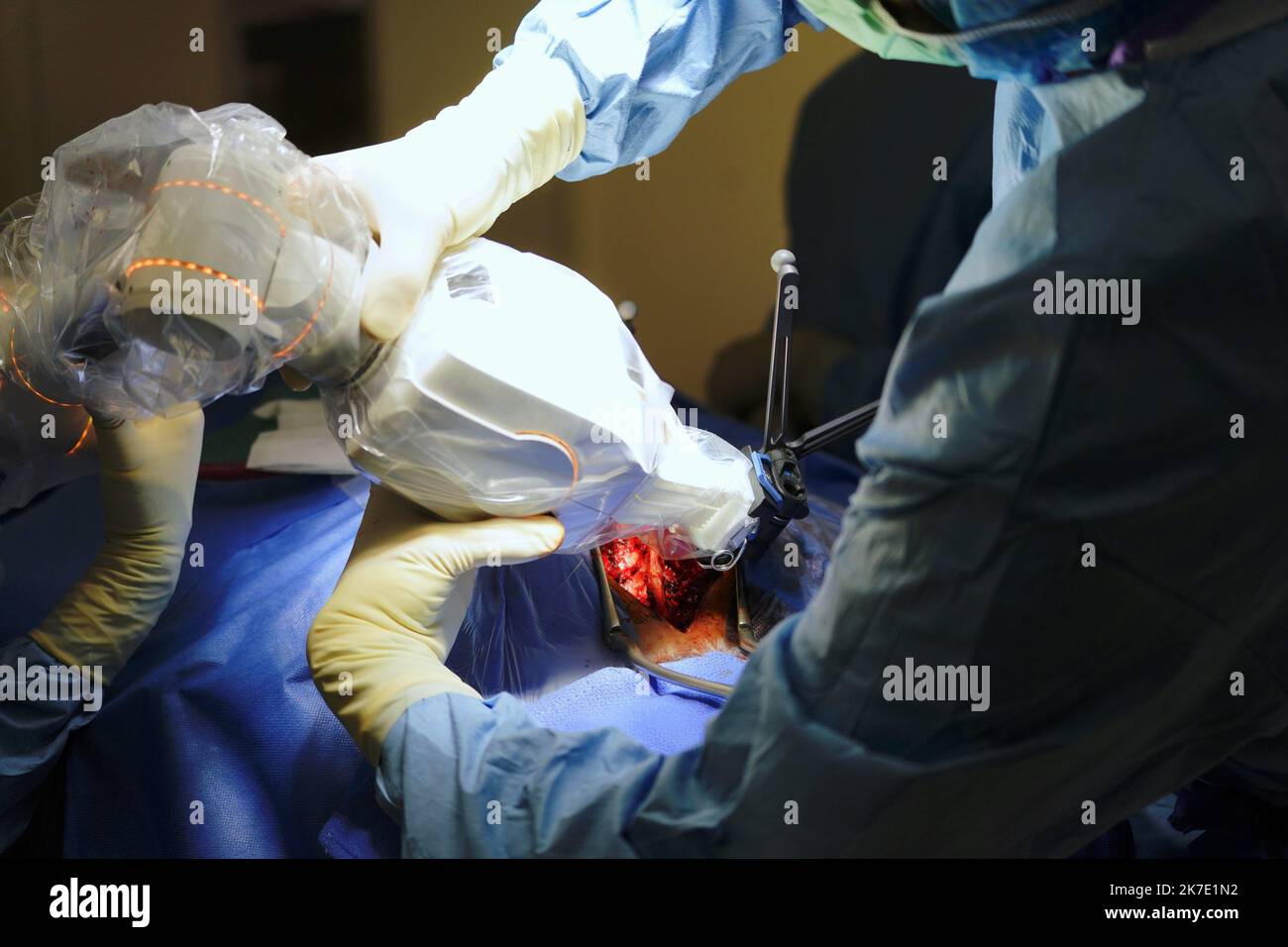 ©PHOTOPQR/OUEST FRANCE/Eddy LEMAISTRE ; ANGERS ; 01/06/2021 ; Chirugie du rachis avec utilisation du bras robotisé par le Dr Rogatien Faguer, neurochirurgie au CHU d’Angers. Le CHU d’Angers vient de se doter d’une suite chirurgicale de pointe Loop-X . Inédite en Europe et d’un montant de plus d’un million d’euros elle est mise en service des gestes opérants à haut risque de sélectionner les performances du chirurgie et de la chirurgie de la force de la chirurgie, ainsi que de la chirurgie de la colne vertébrale, de la biopsie profère du tronébral, chirurgie de l’épine chez l’adulte et l’enfant, opérati Banque D'Images