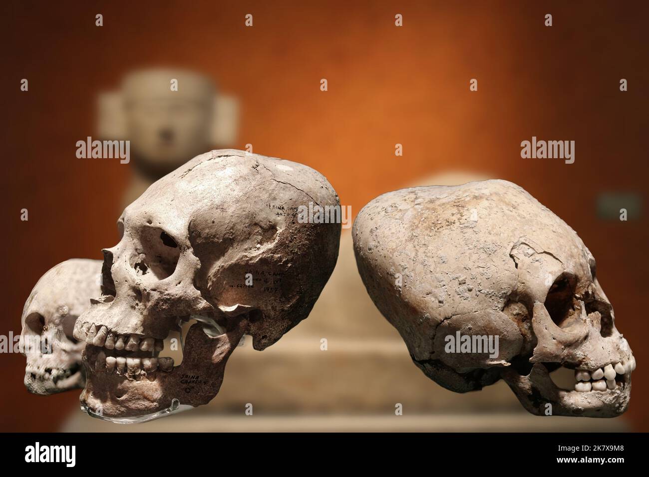 Crânes humains déformés artificiellement pour des raisons esthétiques, comme c'était le cas dans la culture maya Banque D'Images