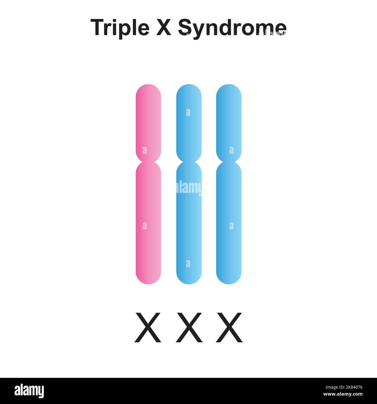 Conception scientifique du syndrome de Triple X (trisomie X). Symboles colorés. Illustration vectorielle. Illustration de Vecteur