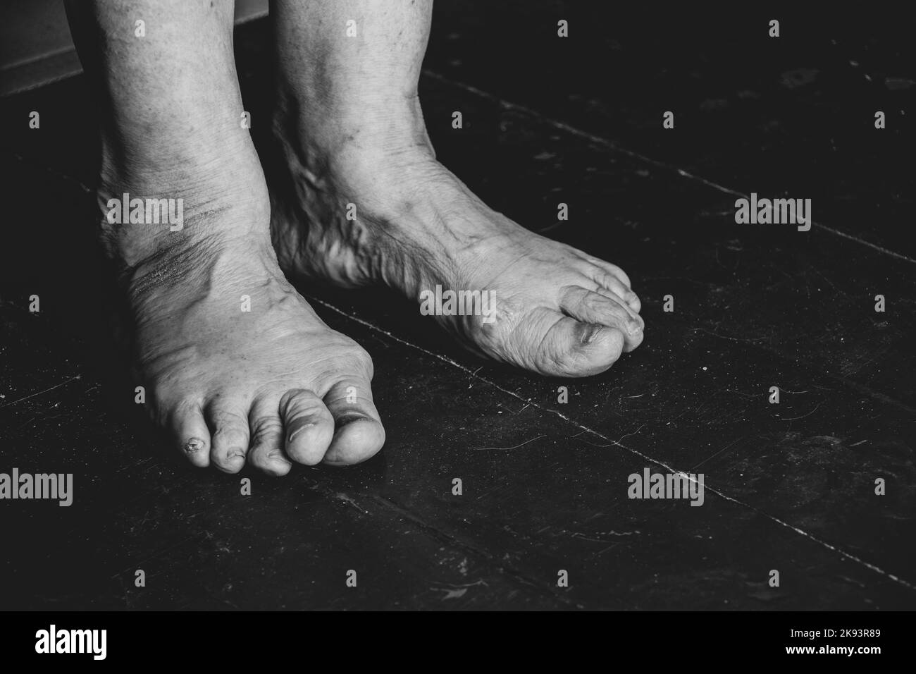 pieds d'une vieille grand-mère sur un plancher en bois sale, solitude, pieds d'un vieil homme, pensionné dans la pauvreté Banque D'Images