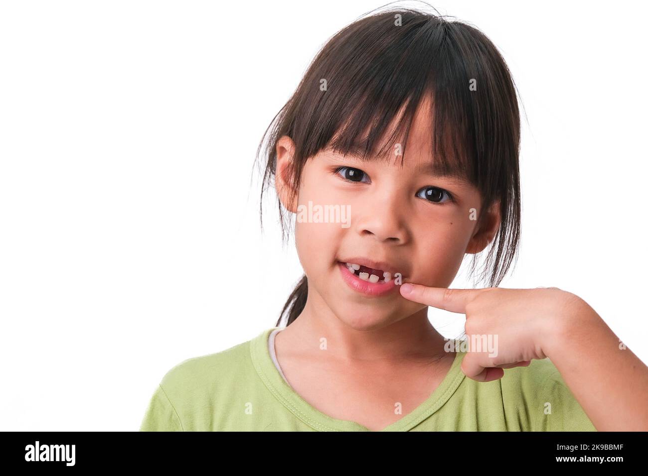 Portrait d'une fille asiatique avec des dents de bébé supérieures cassées et des dents permanentes premières. Petite fille sympathique montrant ses dents cassées isolées sur le dos blanc Banque D'Images