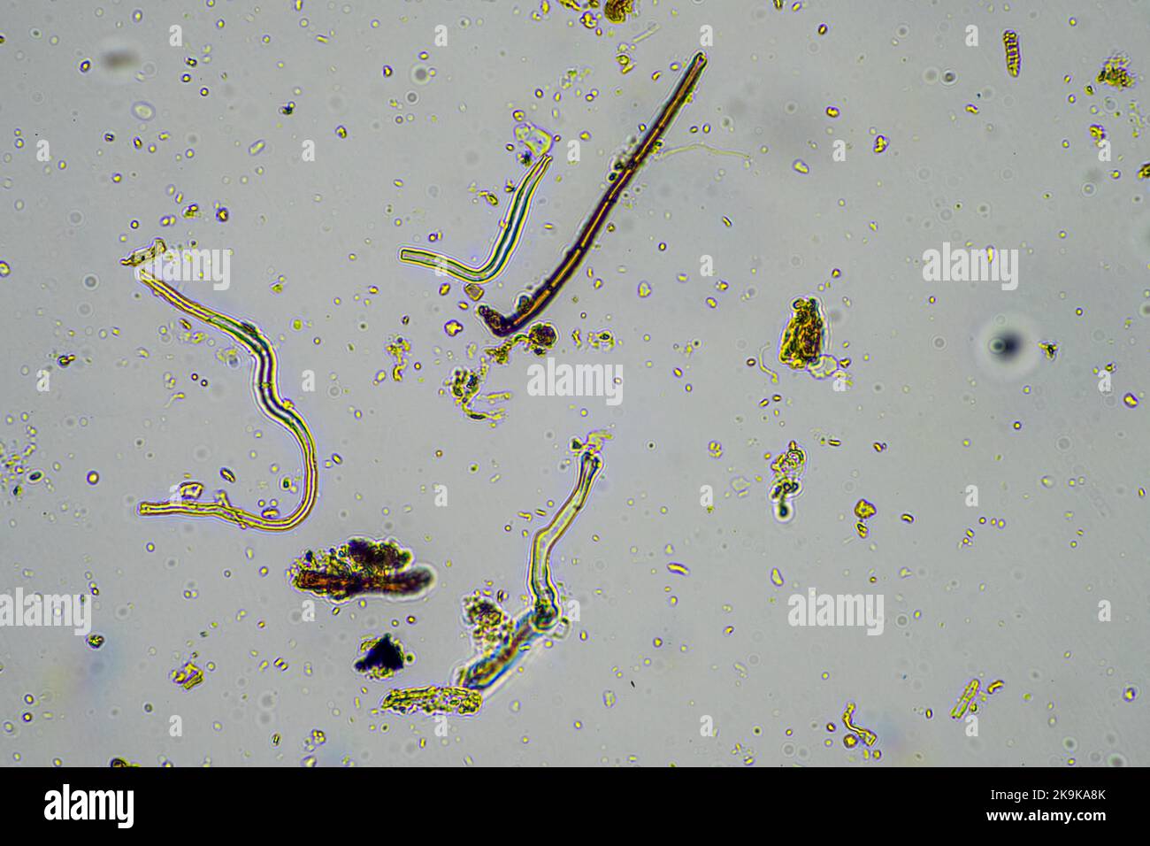 micro-organismes et biologie du sol, avec des nématodes et des champignons au microscope. dans un échantillon de sol et de compost au printemps Banque D'Images