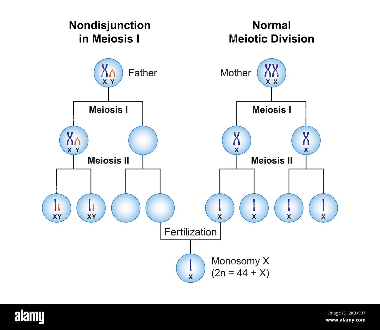 Conception scientifique de la non-disjonction en monosomie X (syndrome de Turner) . Symboles colorés. Illustration vectorielle. Illustration de Vecteur